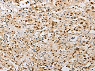SAE1 Antibody