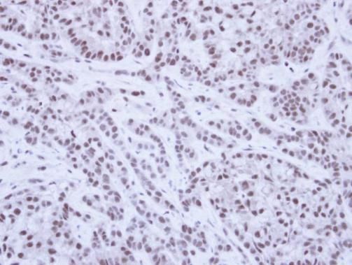 SAE1 antibody