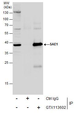 SUMO1 activating enzyme subunit 1 Antibody