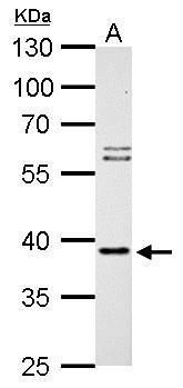 SUMO1 activating enzyme subunit 1 Antibody