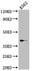 SAE1 Recombinant Monoclonal Antibody