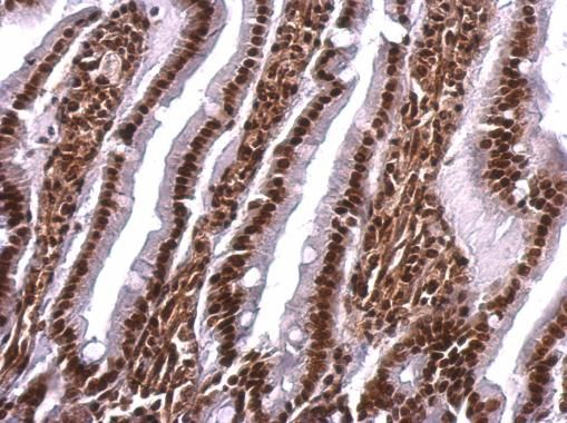 scaffold attachment factor B Antibody