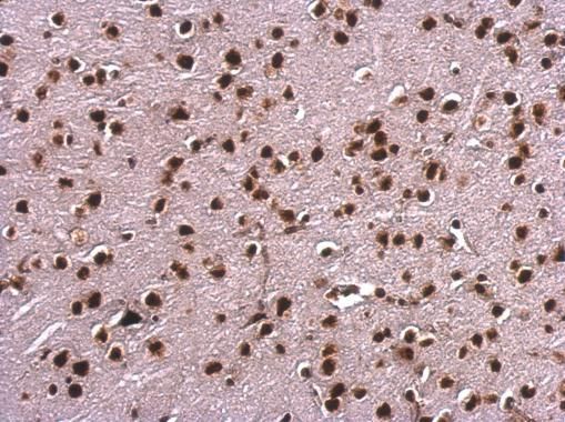 SAFB antibody
