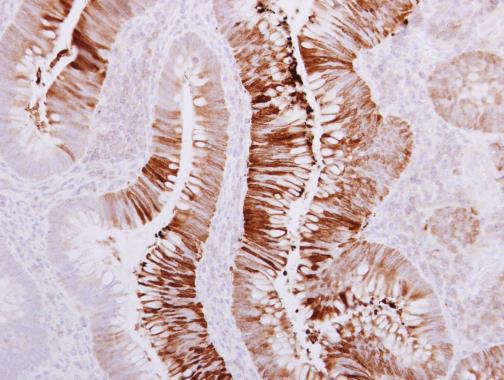 SAH3 antibody [N3C3]