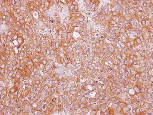 SAH3 antibody [N3C3]