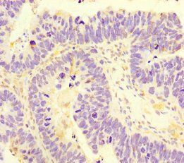 SAMD7 Antibody