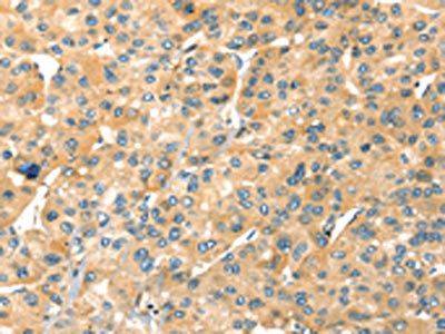 SAMD7 Antibody