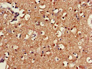 SAMD8 Antibody