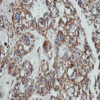 SAMHD1 antibody