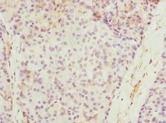 SAP30BP Antibody