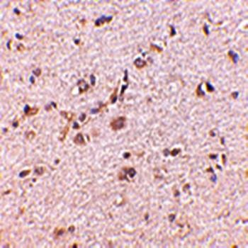 SAPAP1 Antibody