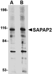 SAPAP2 Antibody