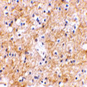 SAPAP3 Antibody