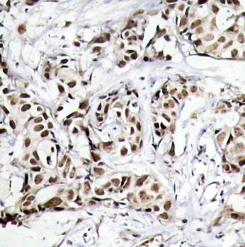 SAPK/JNK (Phospho-Thr183) Antibody