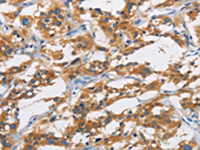 SAR1B Antibody