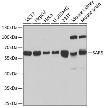 SARS antibody
