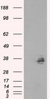 SARS-CoV-2 S Protein Mouse Monoclonal Antibody [Clone ID: OTI3A2]