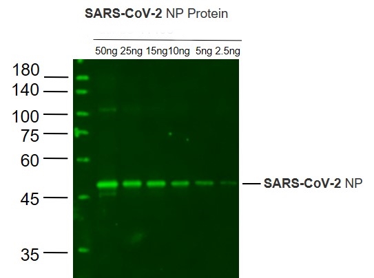 SARS-CoV-2 N protein antibody
