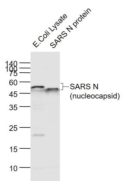 SARS N (nucleocapsid) antibody