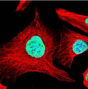 SART1 antibody