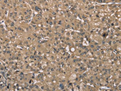 SASH1 Antibody