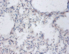 SAT1 Antibody