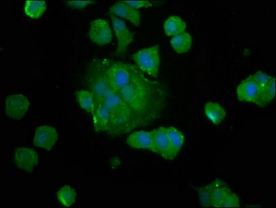 SAT2 antibody