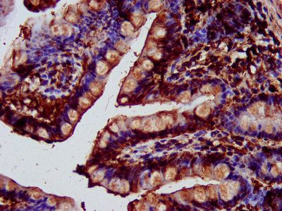 SAT2 Antibody