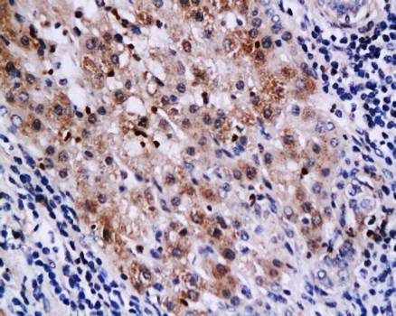 SATB1 Rabbit Polyclonal Antibody