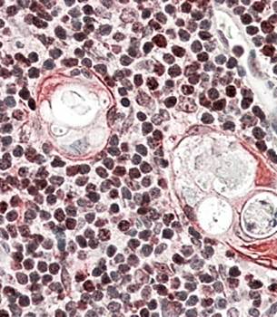 Goat anti-SATB1 Antibody