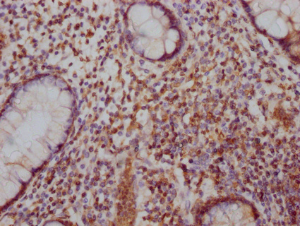 SATB2 Antibody