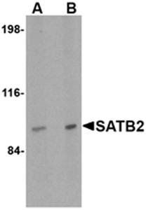 SATB2 Antibody