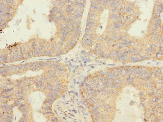 SAV1 Antibody