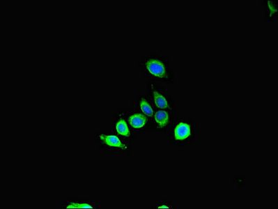 SBF2 Antibody