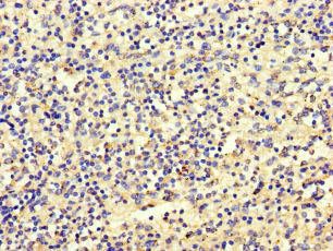SBF2 Antibody