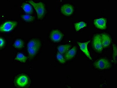 SBK2 Antibody