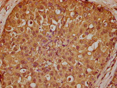 SBK2 Antibody
