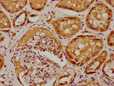 SBK2 Antibody