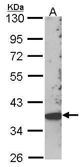 SCAP2 antibody [C2C3], C-term