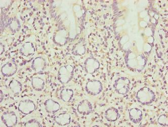 SCAPER Antibody