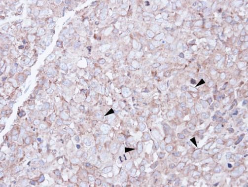 SCARA3 antibody