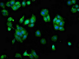 SCARA5 antibody