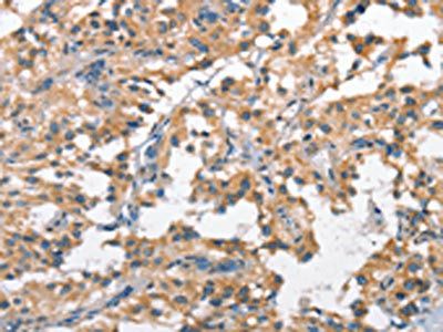 SCARB1 Antibody
