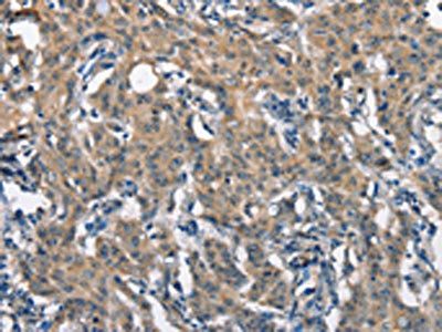 SCARB1 Antibody