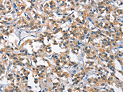 SCARB1 Antibody