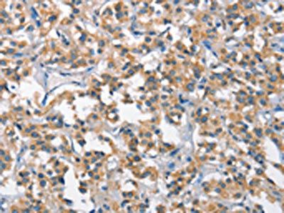 SCARB1 antibody