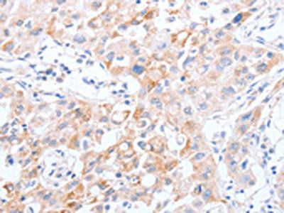 SCARB1 Antibody