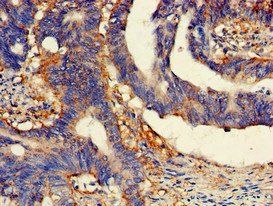 SCARB2 Antibody