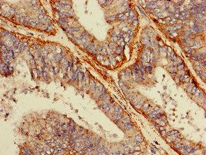 SCARB2 Antibody