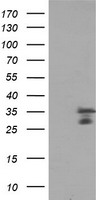 PDGFD Antibody